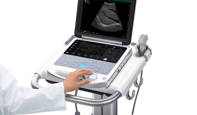 SonoSite ultrasound system with imaging display and control interface