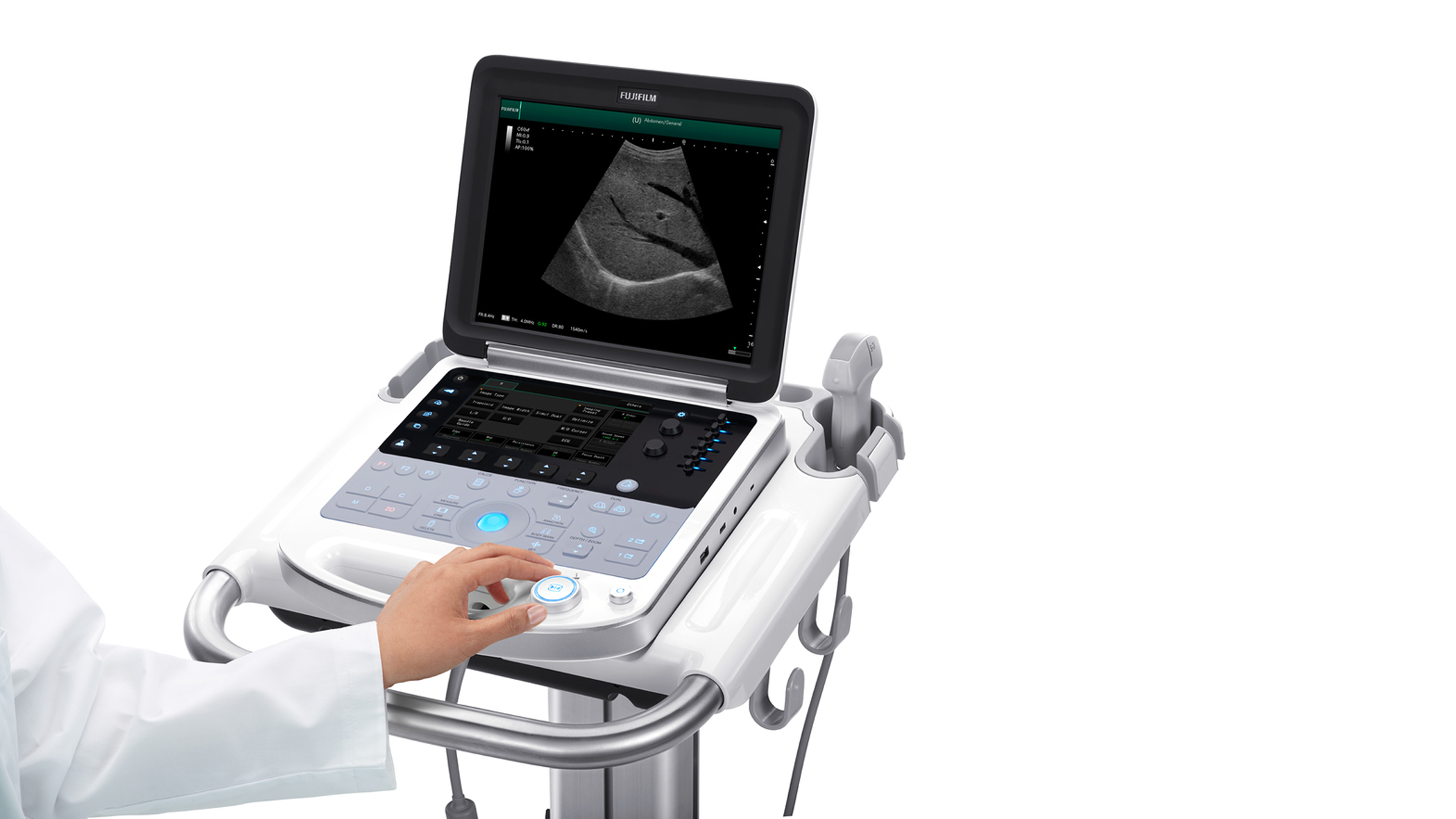 Sonosite case study slide 10
