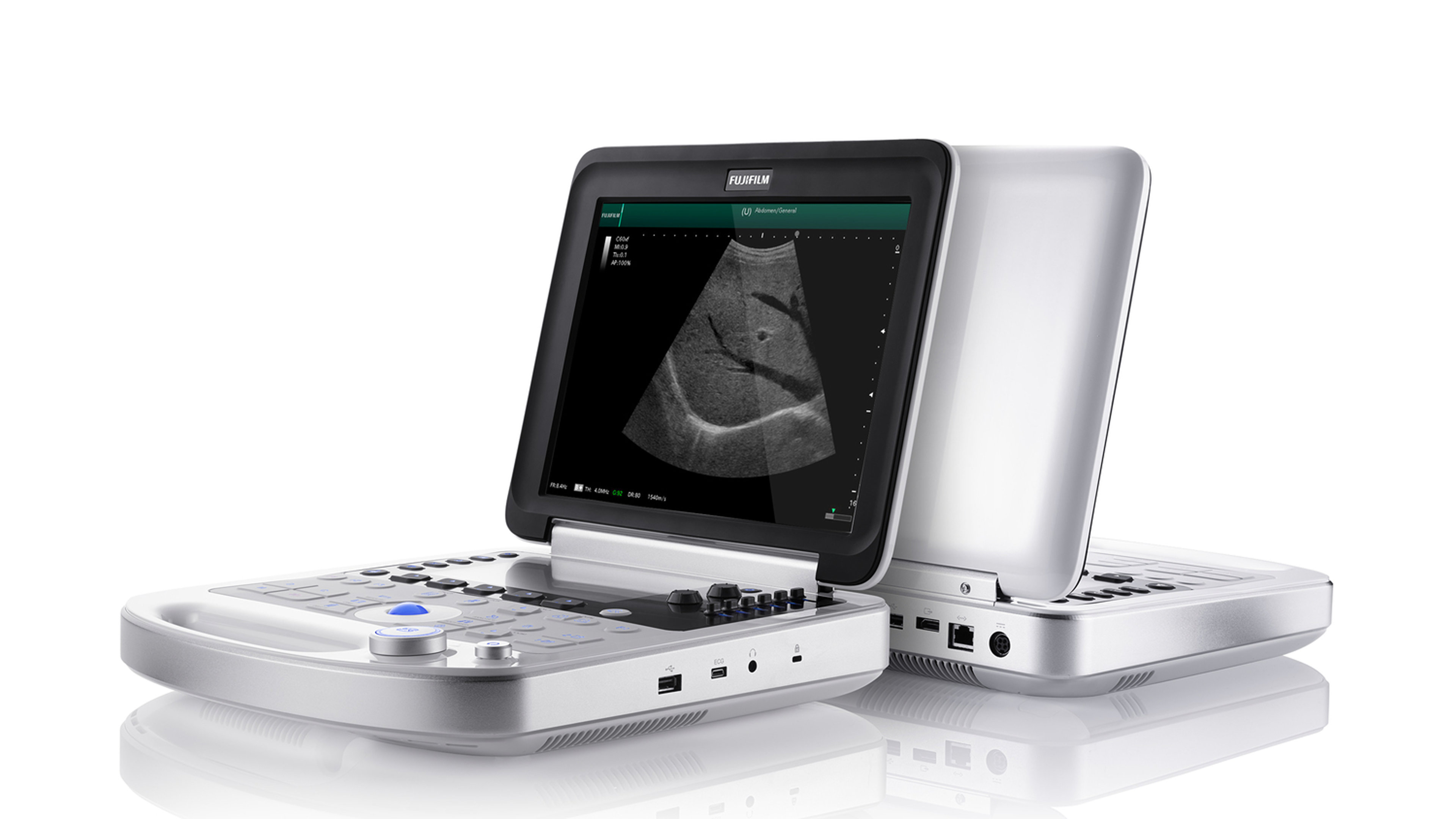 Sonosite case study slide 12