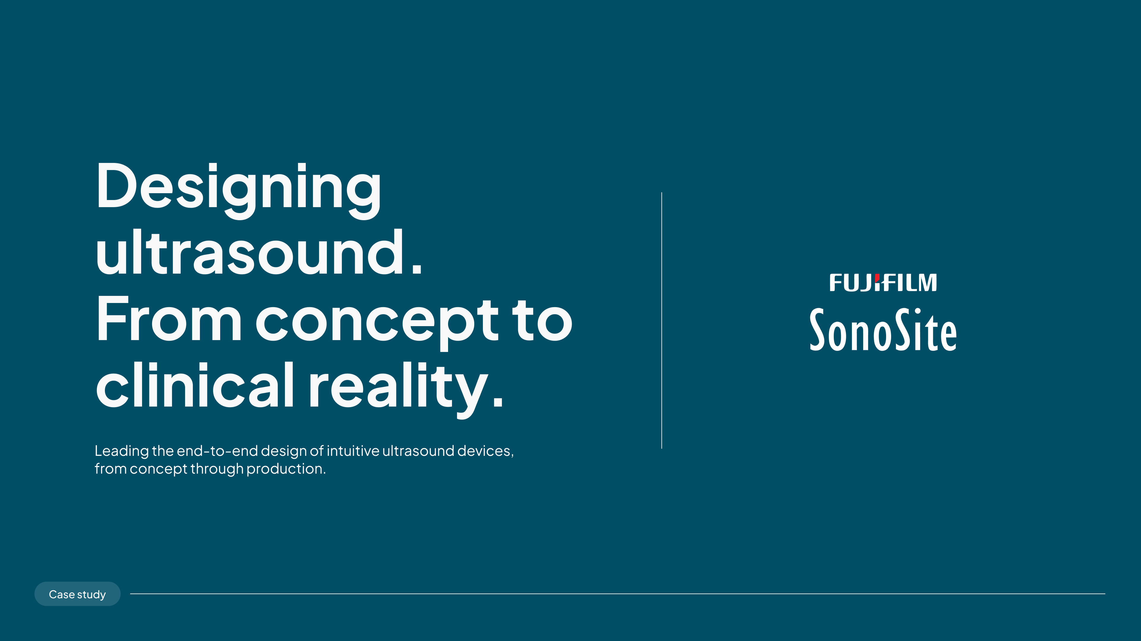 Sonosite case study slide 2