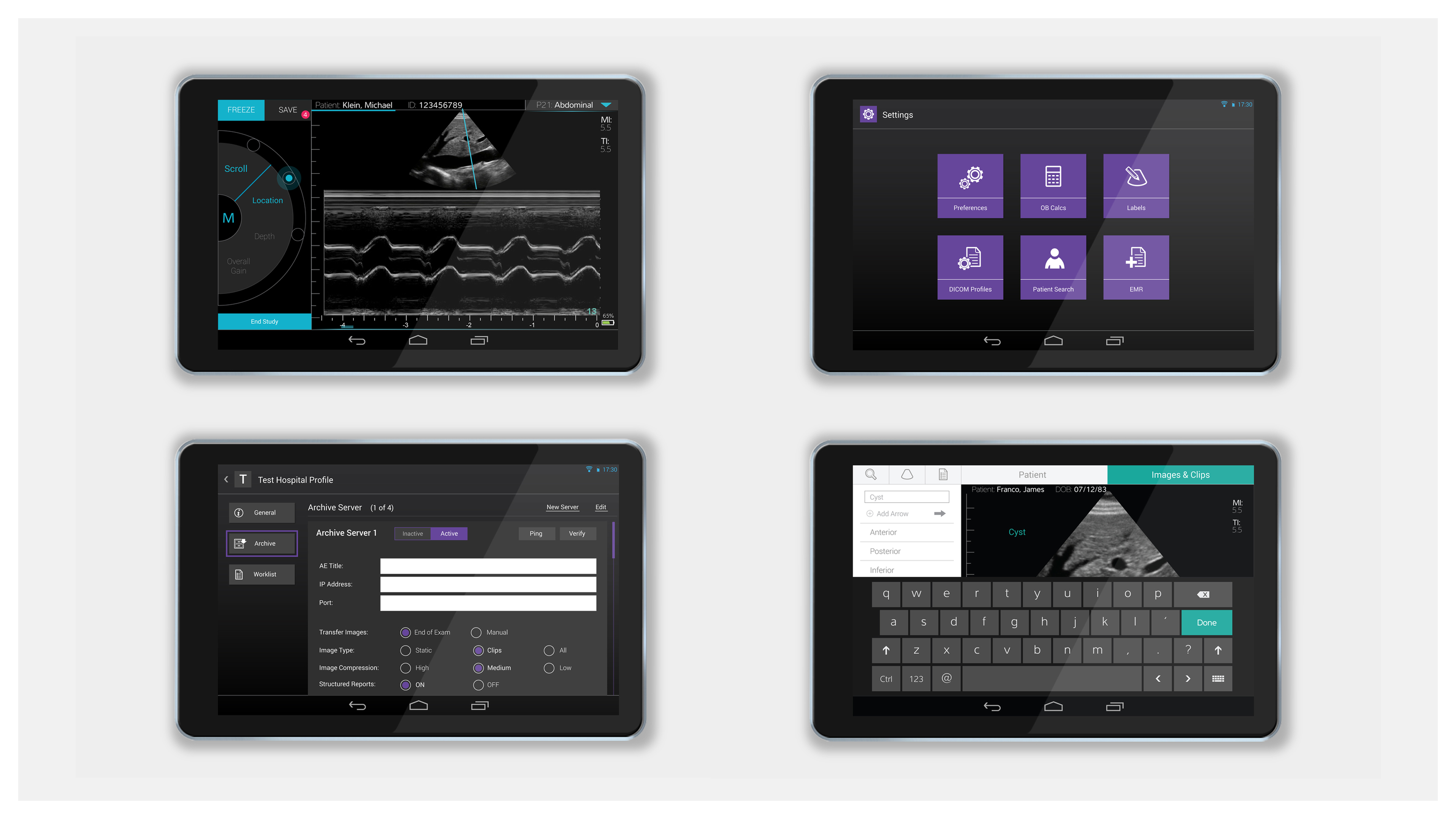 Sonosite case study slide 4