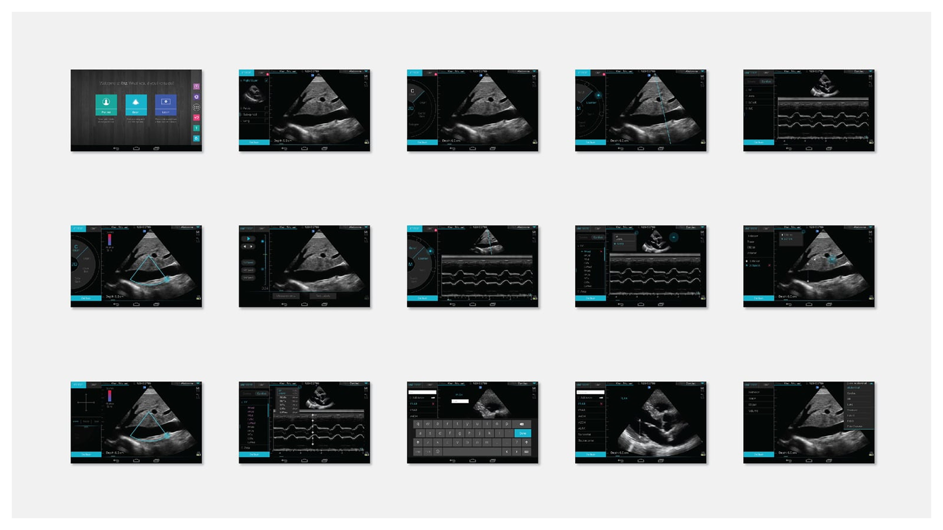 Sonosite case study slide 5
