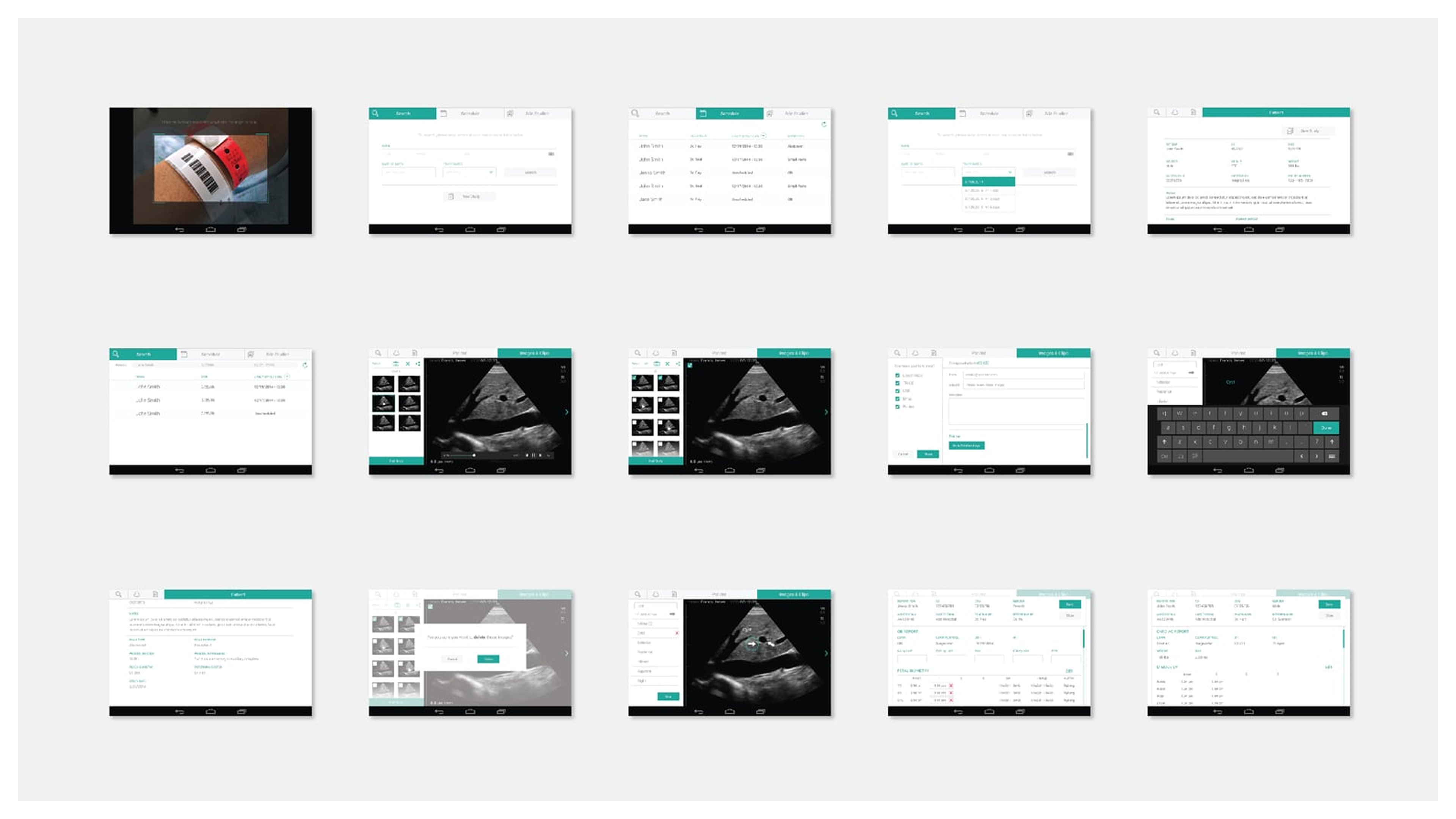 Sonosite case study slide 6