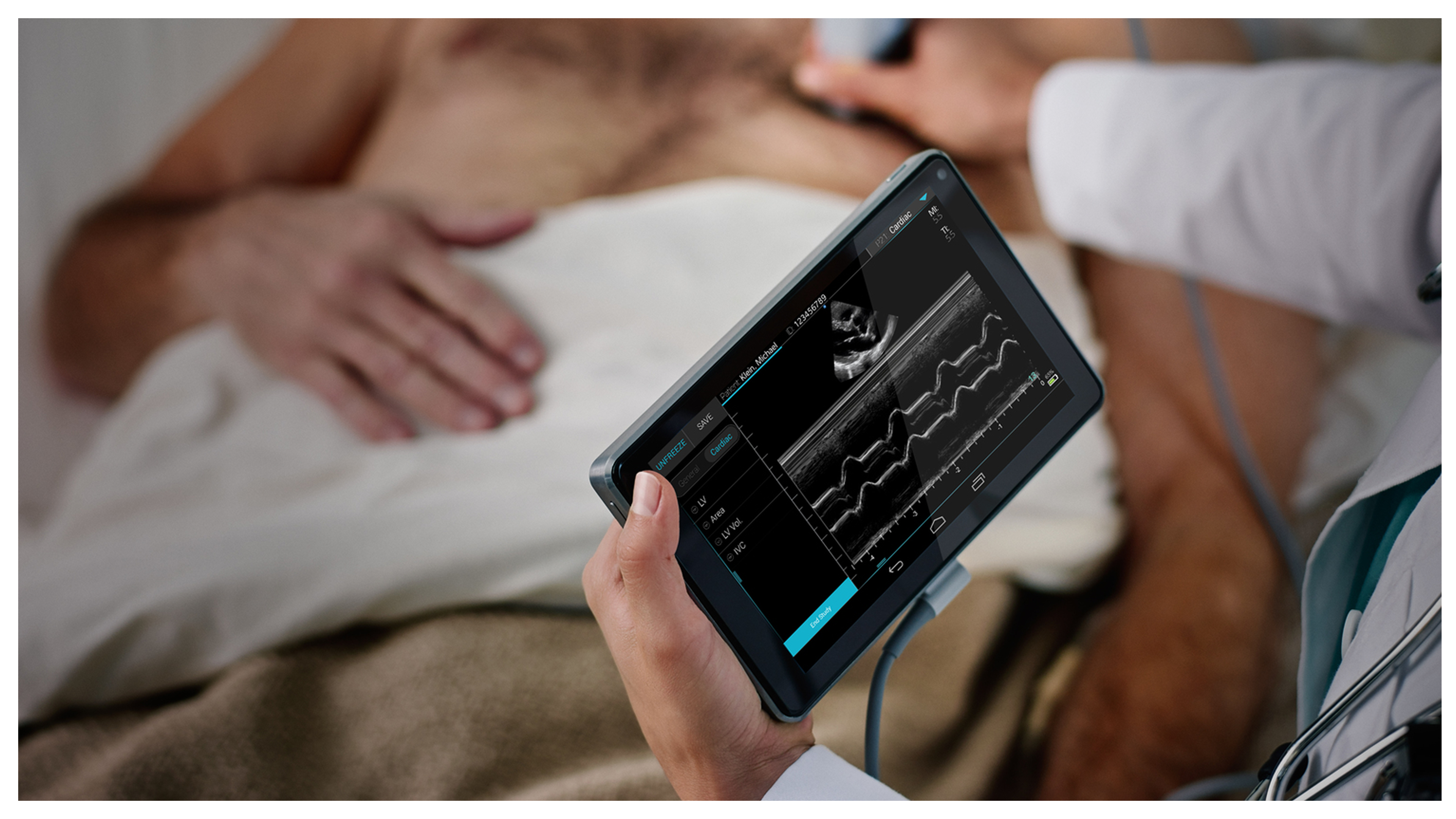 Sonosite case study slide 8